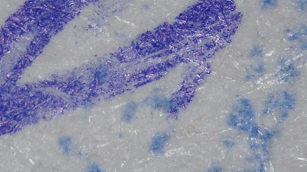 Smart G-Scope Capillaroscope - Basic package